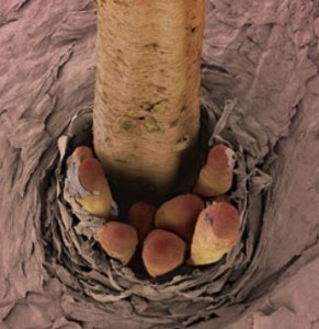mites